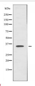 DECR2 Antibody