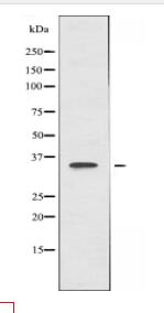 GNAT1 Antibody