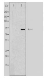FZD8 Antibody