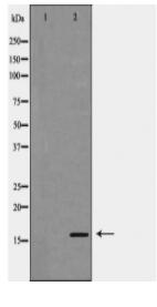 EIF5A Antibody