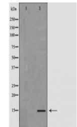 FABP4 Antibody