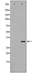 AQP4 Antibody