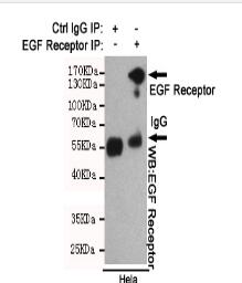 EGF Receptor Mouse mAb