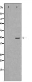 GSK3B Antibody