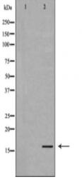 Histone H3K79me2 Antibody