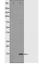 HIST2H2BE Antibody