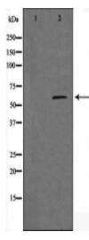 Cytochrome P450 11A1 Antibody