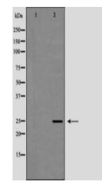 FBXO32 Antibody