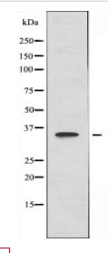 GGH Antibody