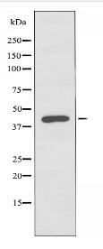 ABHD12 Antibody