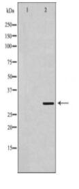 FCER1A Antibody