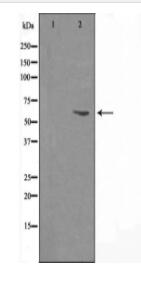 Cytochrome P450 27A1 Antibody