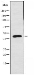 DKK3 Antibody