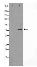 Cytochrome P450 2R1 Antibody