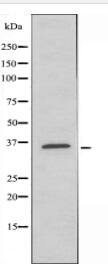 ELOVL4 Antibody