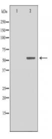 Cytochrome P450 19A1 Antibody