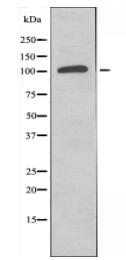 EPHB6 Antibody