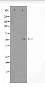 Cytochrome P450 8B1 Antibody