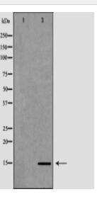 FABP2 Antibody