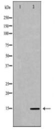 Histone H3K36me2 Antibody