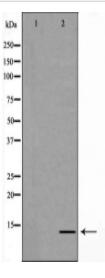 GABARAP Antibody