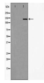 DCTN1 Antibody