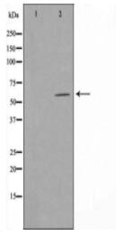FOXJ1 Antibody