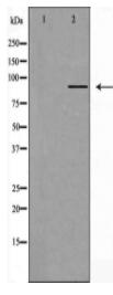 Cytochrome P450 2C8 Antibody