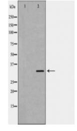 GIPC2 Antibody