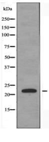 DTYMK Antibody