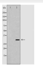 GJB3 Antibody