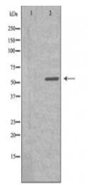 Cytochrome P450 2S1 Antibody