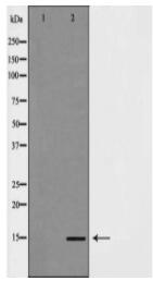 H3K14me2 Antibody