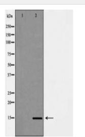 CYB5A Antibody