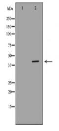 HIF1AN Antibody