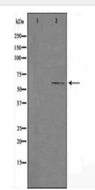 Cytochrome P450 4F11 Antibody