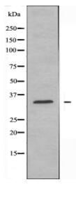 FCGR2C Antibody