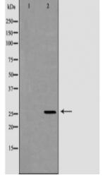GSTM2 Antibody