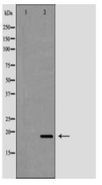 FTL Antibody