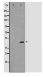 Cyclin D1 Antibody