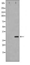 FCGR3A Antibody