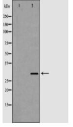 HLA-DRA Antibody