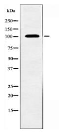 ATP2A1 Antibody