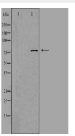 EHHADH Antibody
