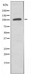 EPHB1 Antibody
