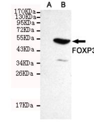 FOXP3 Mouse mAb