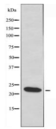 GJB7 Antibody