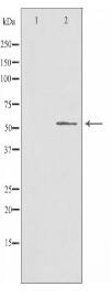 CHST2 Antibody
