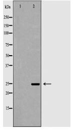 CRP Antibody