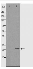 CSRP1 Antibody